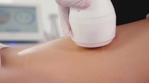 Medical Device Procedure on Leg