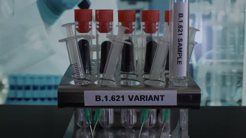 B.1.621 Proben des Reagenzglases werden in das Gestell gelegt. Abgesperrt, Schuss wird eingerichtet