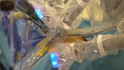 Robotic Surgery Arm Performing Medical Procedure