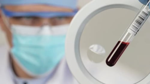 Blood Sample Analyzed in Medical Lab Close Up