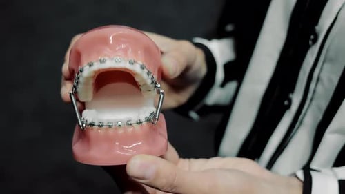 Jaw Model with Braces Being Demonstrated