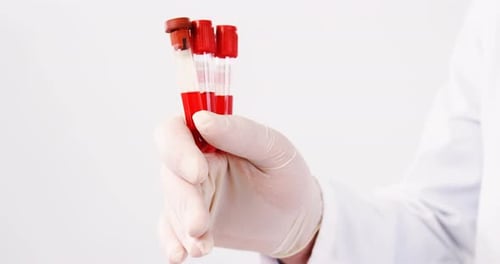 Gloved Hand Holding Blood Test Tubes in Lab