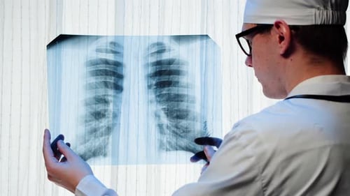 Doctor Examining Chest X-Ray in Hospital