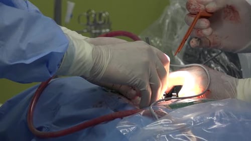 chirurgie du rachis