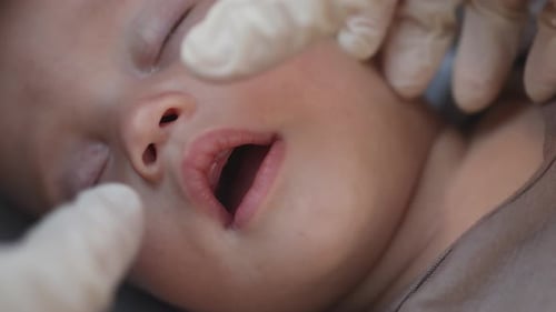 Les médecins vérifient les mains du bébé endormi, premier lait, dentition, dentition des gencives