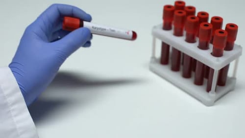 Positiver Karyotyptest, Arzt zeigt Blutprobe im Röhrchen, Gesundheitsuntersuchung