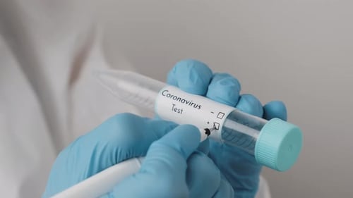 Marking Positive Coronavirus Test Result in Lab