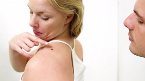 Concerned Woman Examines Mole on Shoulder with Doctor