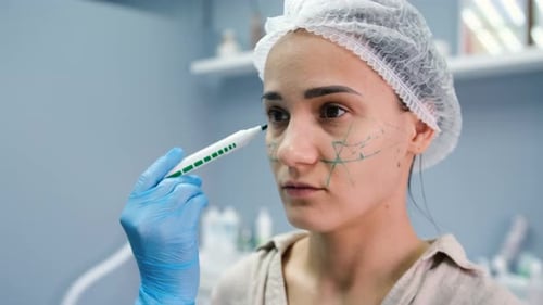 Der Arzt, der Kosmetologe macht einer jungen Frau vor der kosmetischen Injektion von Hyaluron Gesichtsmarkierungen