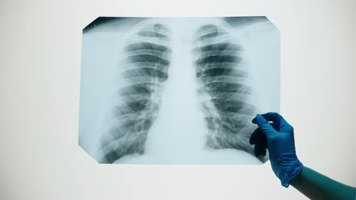 Examining Ribs on X-Ray in Clinic