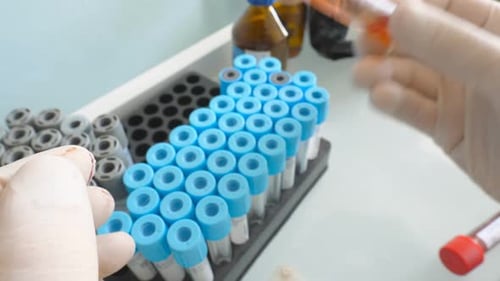 Gloved Hands Holding Coronavirus Blood Sample Test Tube