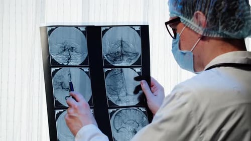 Doctor Examining Xraybrain MRI