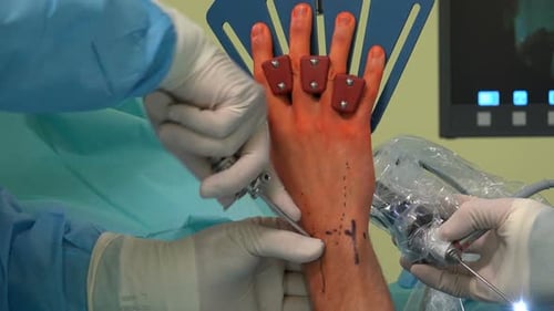 Wrist Arthroscopy