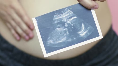 femme enceinte tenant une image échographique du fœtus dans une main et le touchant, la caresse, le ventre