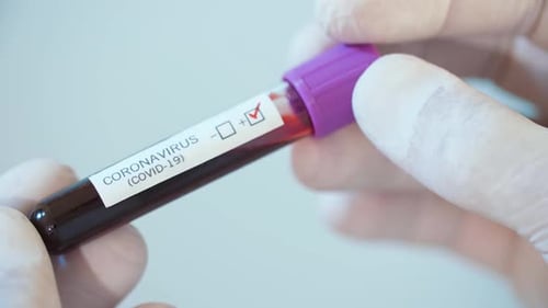 Test auf Coronavirus in einer Hand eines Arztes