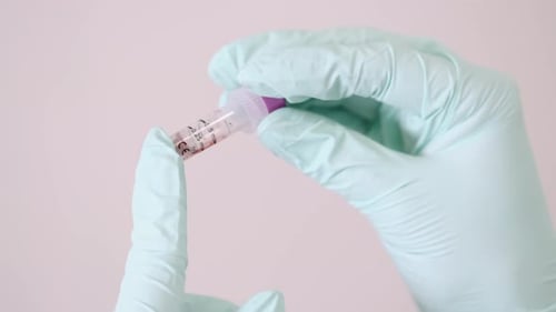 Medical Female Worker Looking at Blood Test Sample in the Clinic