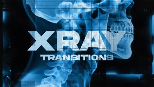 Medical X-Ray Reveal Glitch Transitions