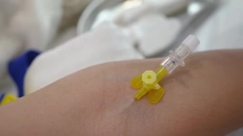 IV Catheter Placed in Arm Close Up