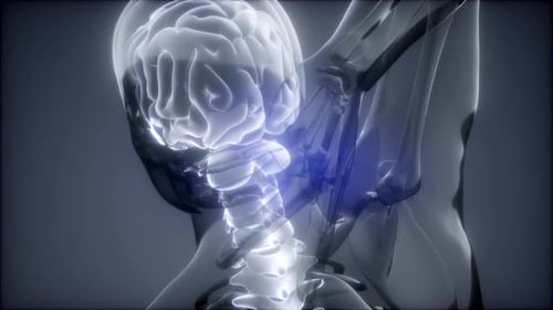 Backache in Back Bones