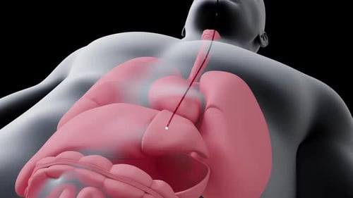 3D Endoscopic Catheter Entering Human Digestive System Animation