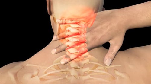 Human Neck Pain and Spinal Column Animation