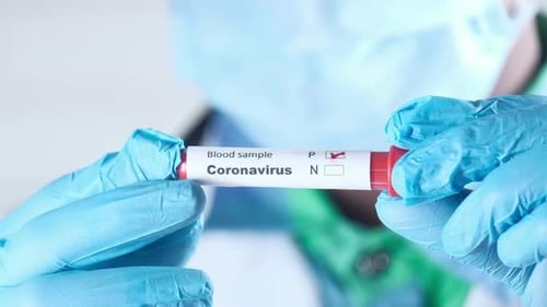 Coronavirus Blood Sample Test Positive in Lab
