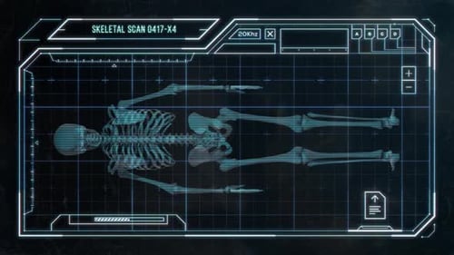 Futuristic Skeletal Scan Medical HUD Display