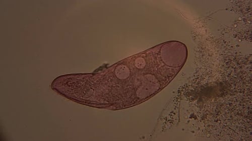 A microscopic view of the single-celled organism, Blepharisma.