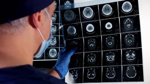 Surgeon Checking Mri