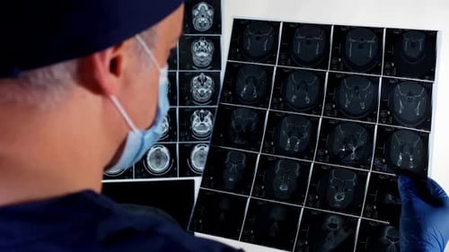 Adult Doctor Examines Brain X-Ray Scan in Hospital
