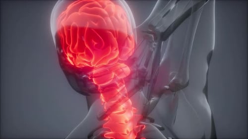 Backache in Back Bones