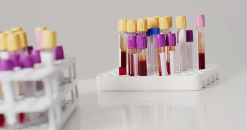 Video of close up of test tubes on white background