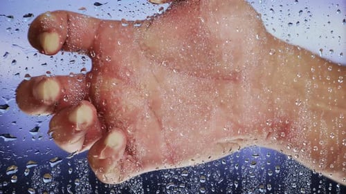 Raindrops on Glass with Visible Hand