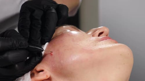 Facial Cosmetic Procedure Close Up in Clinic