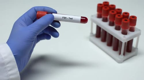 FSH Blood Test Analysis in Laboratory