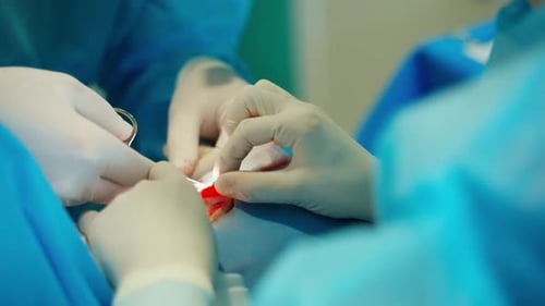 Plastic surgery of patient. Doctors performing cosmetic surgery in hospital operating room