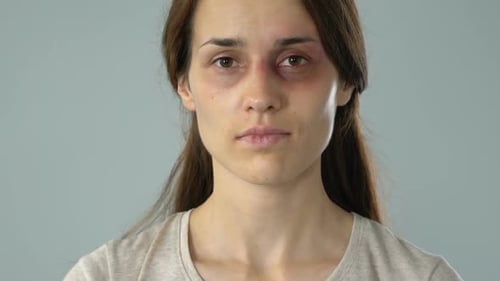 Stoppen Sie sexuelle Übergriffe in verletzten Frauenhänden, Bewusstsein für Missbrauch, Menschenrechte