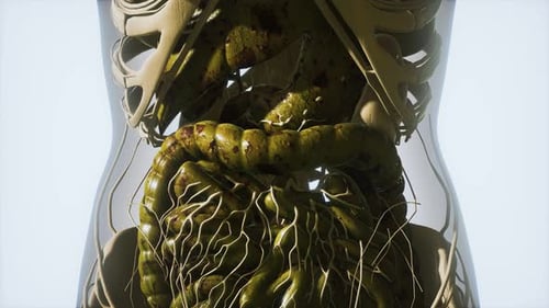 Diseased Human Digestive System Anatomy with Inflammation Animation