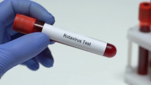 Rotavirus Test, Doctor Holding Blood Sample in Tube Close-Up, Health Check-Up