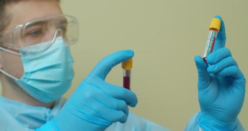 Doctor Looking Test Tube for Checking Covid-19 in the Blood Slow Motion.