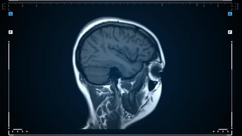 MRI Scan of a Human Brain in Motion