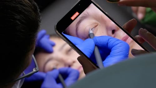 Eye Exam Medical Procedure Filmed on Phone