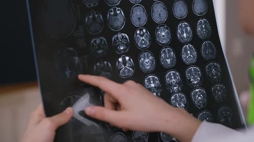 Person Analyzes a Detailed Brain Scan Image
