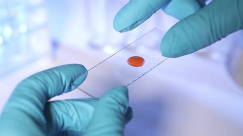 Lab Technician Holding Pipette and Testing Blood Samples on Hospital Ward for Blood Transfusion