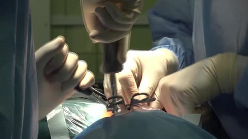 Surgeons Performing Intricate Operation in Hospital Setting