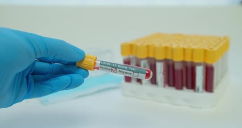 COVID-19 Blood Test is Negative