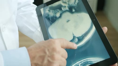 Close-up of Doctor's Hand Touching Tablet Screen with MRI Results of Patient