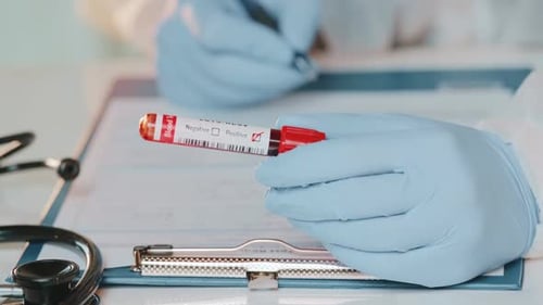 Positive Coronavirus Blood Test Marked by Gloved Hand