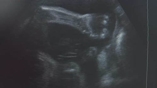 Ultrasonography of Pregnant Woman. Unborn Baby in Womb Moving During Medical Examination. Prenatal