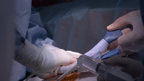 Surgeons Performing Medical Procedure Close Up
